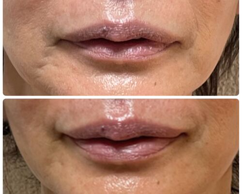 303B278A-9448-4ACB-859B-344F3EE327DE