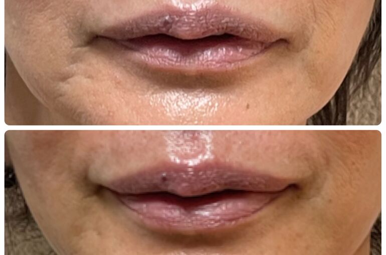 303B278A-9448-4ACB-859B-344F3EE327DE