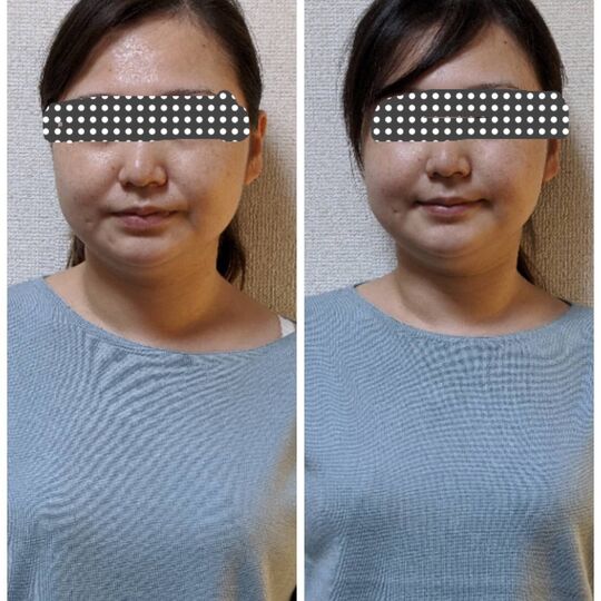 44E28AE5-F3A6-47DC-A519-F67806BED4FE